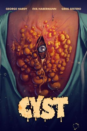 Cyst streaming