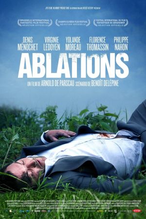 Ablations streaming